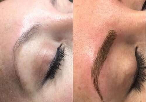 BROWS BEFORE AND AFTER