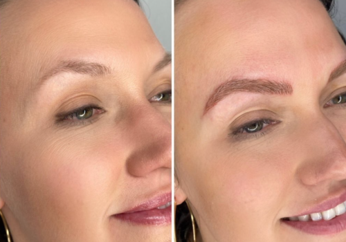 BROW BEFORE & AFTER